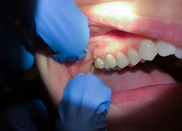 Best Mobile Emergency Dentist in Talty, TX
